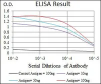 Anti-Cytokeratin 5 antibody [2C2] used in ELISA (ELISA). GTX60580