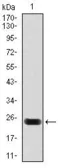 Anti-Cardiac Troponin T antibody [1G1] used in Western Blot (WB). GTX60592