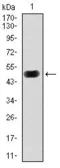 Anti-PKA C gamma antibody [2E4] used in Western Blot (WB). GTX60597