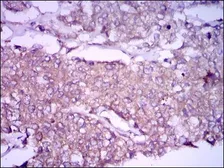 Anti-Glypican-3 antibody [9C2] used in IHC (Paraffin sections) (IHC-P). GTX60603