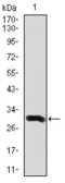 Anti-Doublecortin antibody [2G5] used in Western Blot (WB). GTX60612