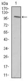 Anti-VAV1 antibody [2E11] used in Western Blot (WB). GTX60621