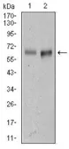 Anti-CD166 antibody [5B3] used in Western Blot (WB). GTX60629