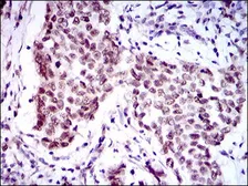 Anti-FOXP1 antibody [6E4] used in IHC (Paraffin sections) (IHC-P). GTX60643