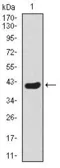 Anti-Twist1 antibody [2F8E7] used in Western Blot (WB). GTX60657