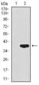 Anti-CD59 antibody [8D2B8] used in Western Blot (WB). GTX60658