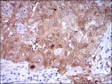 Anti-CDKN2A / p16INK4a antibody [1D7D2] used in IHC (Paraffin sections) (IHC-P). GTX60663