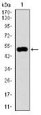 Anti-KEAP1 antibody [7G4B10] used in Western Blot (WB). GTX60664