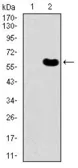 Anti-DKK3 antibody [8A5C6] used in Western Blot (WB). GTX60665
