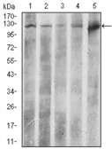 Anti-ATP citrate lyase antibody [5F8D11] used in Western Blot (WB). GTX60666
