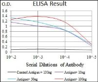 Anti-SFTPC antibody [5E6A9] used in ELISA (ELISA). GTX60670