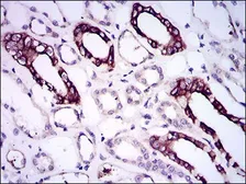 Anti-BMPR1A antibody [4B7B2] used in IHC (Paraffin sections) (IHC-P). GTX60675