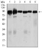 Anti-TGF beta Receptor III antibody [1C5H11] used in Western Blot (WB). GTX60678
