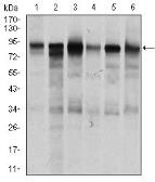 Anti-TGF beta Receptor III antibody [1C5H11] used in Western Blot (WB). GTX60683