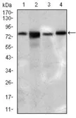 Anti-SLC27A5 antibody [9C4D1] used in Western Blot (WB). GTX60703