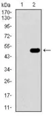 Anti-GUCY1A3 antibody [3G6B2] used in Western Blot (WB). GTX60721