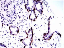 Anti-Cytokeratin 5 antibody [10C11E6] used in IHC (Paraffin sections) (IHC-P). GTX60722
