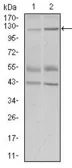 Anti-PIWIL4 antibody [10G9B11] used in Western Blot (WB). GTX60725