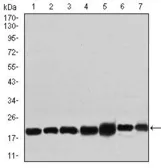 Anti-RPL18A antibody [6G6G10] used in Western Blot (WB). GTX60729