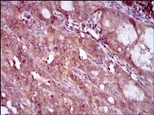Anti-EGFR (mutant) antibody [5G9B5] used in IHC (Paraffin sections) (IHC-P). GTX60766