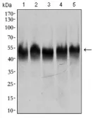 Anti-TUBB2A antibody [6A10B2] used in Western Blot (WB). GTX60773