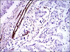 Anti-GSC antibody [4C5D5] used in IHC (Paraffin sections) (IHC-P). GTX60774