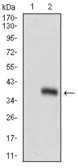 Anti-GSC antibody [4C5D10] used in Western Blot (WB). GTX60784