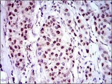 Anti-Napsin A antibody [10C4B8] used in IHC (Paraffin sections) (IHC-P). GTX60785