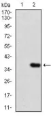 Anti-IL3 Receptor alpha antibody [8E11C5] used in Western Blot (WB). GTX60786