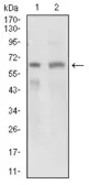 Anti-GPNMB antibody [7C10E5] used in Western Blot (WB). GTX60790
