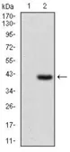 Anti-IL2 Receptor alpha antibody [1B5D12] used in Western Blot (WB). GTX60792