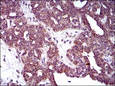 Anti-DRP1 antibody [4E11B11] used in IHC (Paraffin sections) (IHC-P). GTX60794