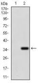 Anti-MRP4 antibody [6A7H3] used in Western Blot (WB). GTX60796
