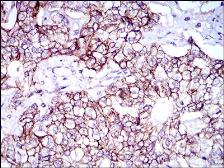 Anti-CD166 antibody [4H9A5] used in IHC (Paraffin sections) (IHC-P). GTX60798