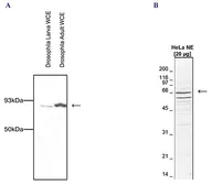 Anti-CDC73 antibody - ChIP grade used in Western Blot (WB). GTX60804