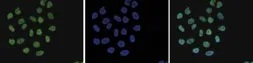 Anti-Histone H4K8ac (acetyl Lys8) antibody - ChIP grade used in Immunocytochemistry/ Immunofluorescence (ICC/IF). GTX60829