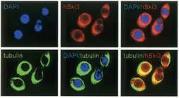 Anti-Ski3 antibody used in Immunocytochemistry/ Immunofluorescence (ICC/IF). GTX60845