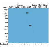 Rabbit Anti-Human IgG4 antibody [RM120]. GTX60865
