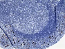 Rabbit Anti-Human IgA2 antibody [RM125]. GTX60870
