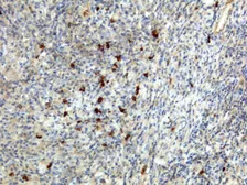 Rabbit Anti-Human IgA antibody [RM128]. GTX60873