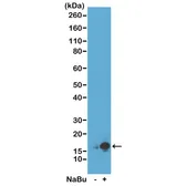 Anti-Histone H3K9ac (Acetyl Lys9) antibody [RM161] used in Western Blot (WB). GTX60885