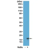 Anti-Histone H3K27ac (Acetyl Lys27) antibody [RM172] used in Western Blot (WB). GTX60887