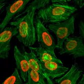 Anti-Histone H3K9me2 (Di-methyl Lys9) antibody [RM151] used in Immunocytochemistry/ Immunofluorescence (ICC/IF). GTX60890