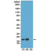 Anti-Histone H3K23ac (Aceyl Lys23) antibody [RM169] used in Western Blot (WB). GTX60911