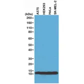 Anti-Histone H4 antibody [RM212] used in Western Blot (WB). GTX60913