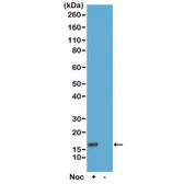 Anti-Histone H3T6ph (phospho Thr6) antibody [RM160] used in Western Blot (WB). GTX60916