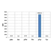 Anti-Phosphotyrosine antibody [RM111] used in  (). GTX60918