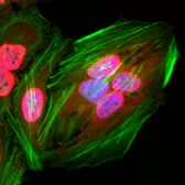 Anti-Acetyl Lysine antibody [RM101] used in Immunocytochemistry/ Immunofluorescence (ICC/IF). GTX60919