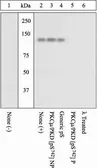 Anti-PKC mu (phospho Ser742) antibody used in Western Blot (WB). GTX60928