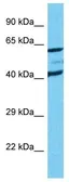Anti-SLC19A1 antibody used in Western Blot (WB). GTX60936